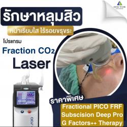 ใหม่ !! โปรคอมโบเลเซอร์ผีลืมหลุม