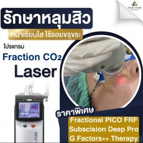 ใหม่ !! โปรคอมโบเลเซอร์ผีลืมหลุม