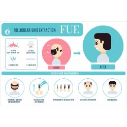 ปลูกผมและคิ้วด้วย FUE ( Follicular Unit Extraction ) Hair Transplantation by FUE